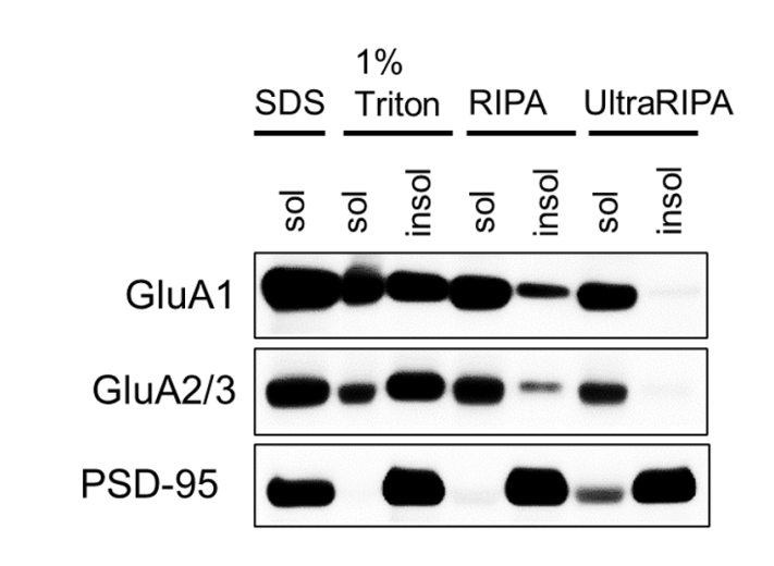 UltraRIPAを用いたマウス脳組織P2膜画分からのタンパク質抽出